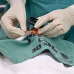 Cirurgia ocular em bebê prematuro