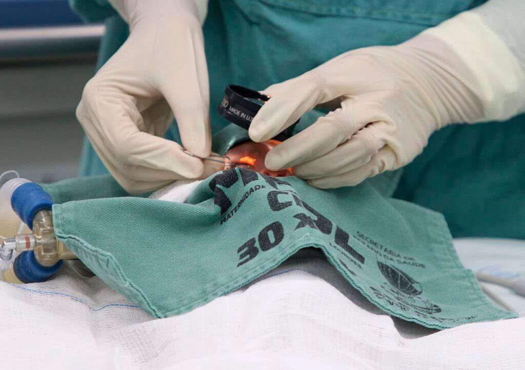 Cirurgia ocular em bebê prematuro
