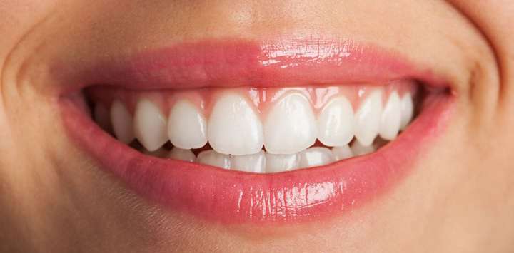 Sorriso com dentes brancos e alinhados