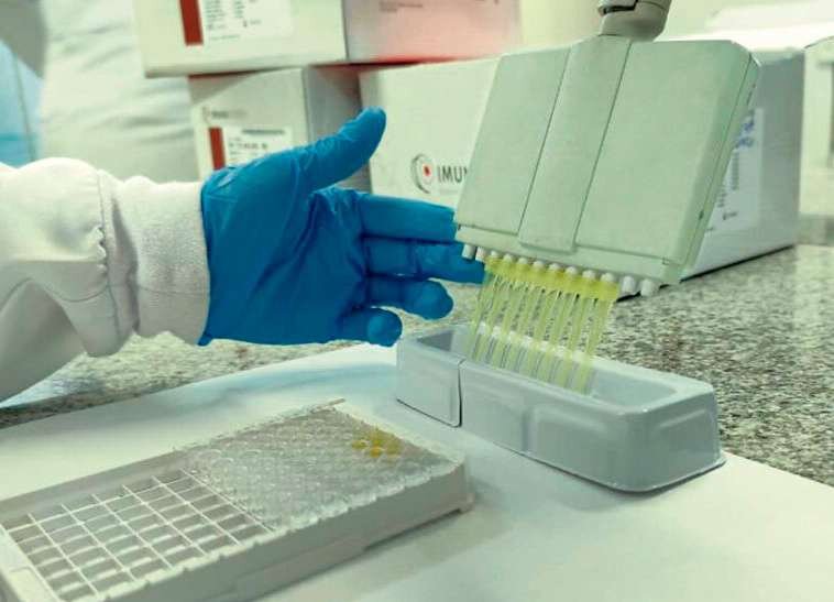 Covid-19: testes em laboratório