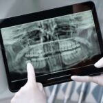Tablet exibindo radiografia panorâmica dentária