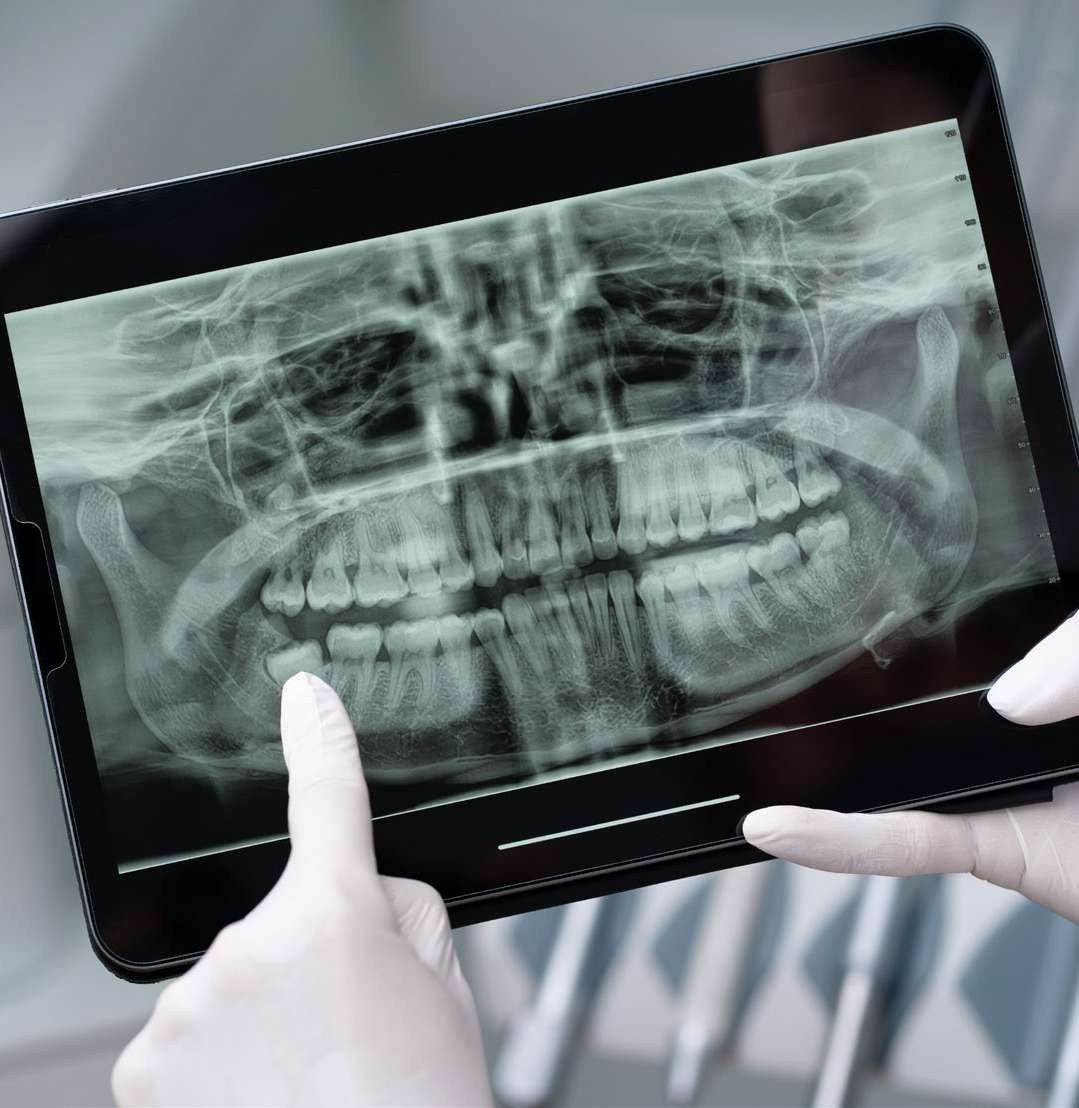 Tablet exibindo radiografia panorâmica dos dentes