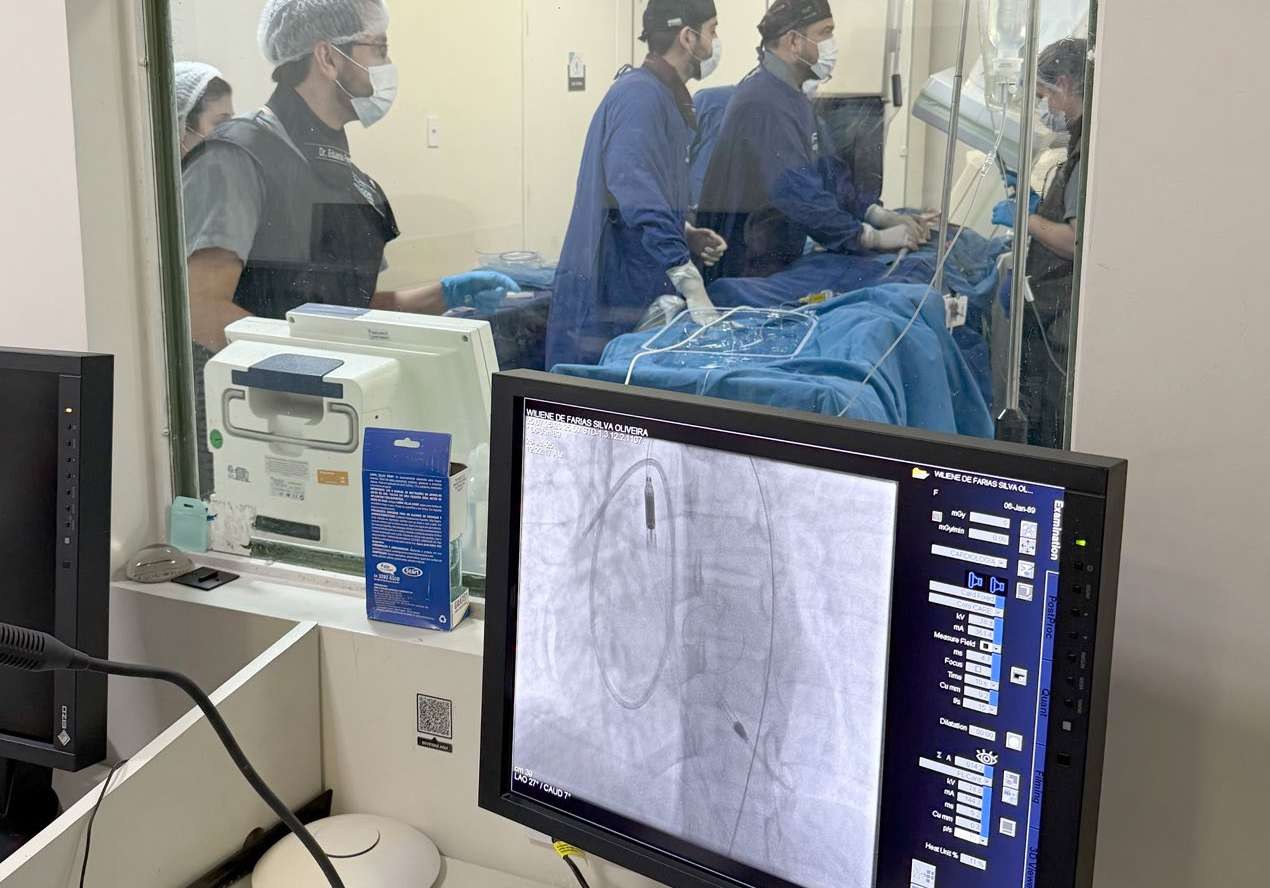 Procedimento no Serviço de Hemodinâmica do Hospital de Cirurgia