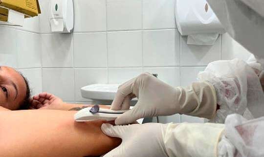 Profissional de saúde realiza inserção de implante contraceptivo no braço de paciente