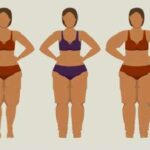 Ilustração de silhuetas femininas com acúmulo de gordura nas pernas