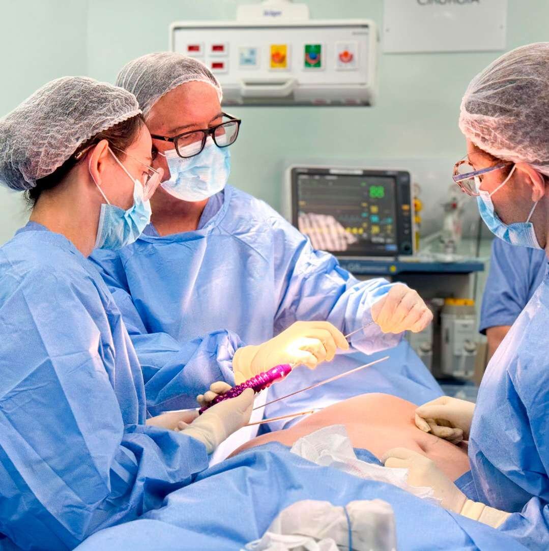 Equipe cirúrgica realiza reconstrução mamária com a técnica Mini Flap de Músculo Grande Dorsal Lipoenxertado