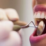 Dentista examina paciente com espelho bucal