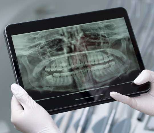 Mão enluvada segura tablet com radiografia panorâmica