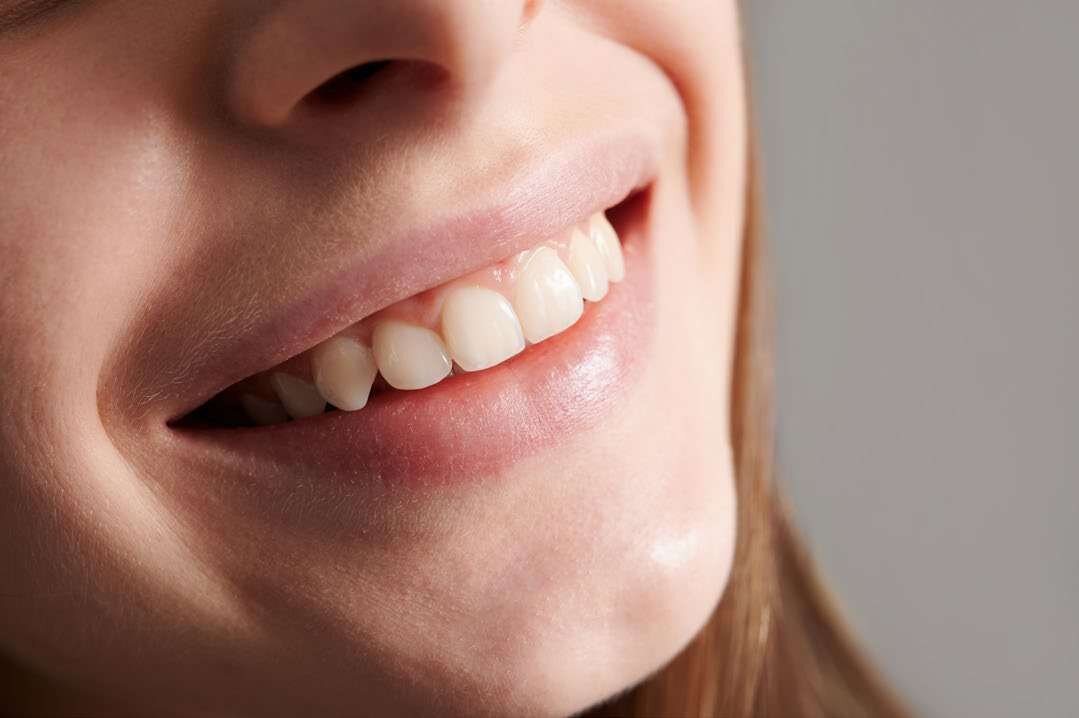 Sorriso em close mostrando dentes e gengiva