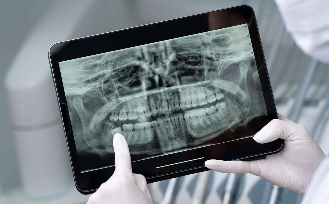 Mão segura tablet com radiografia panorâmica dos dentes