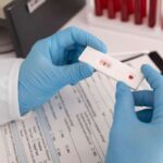 Saúde realiza monitoramento de casos de hiv em Sergipe
