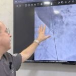 Dr. Eduardo Ferreira aponta imagem de angiografia em monitor