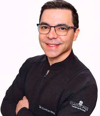 Transplante capilar avança em Sergipe: Dr. Claiton Pires explica novas tecnologias