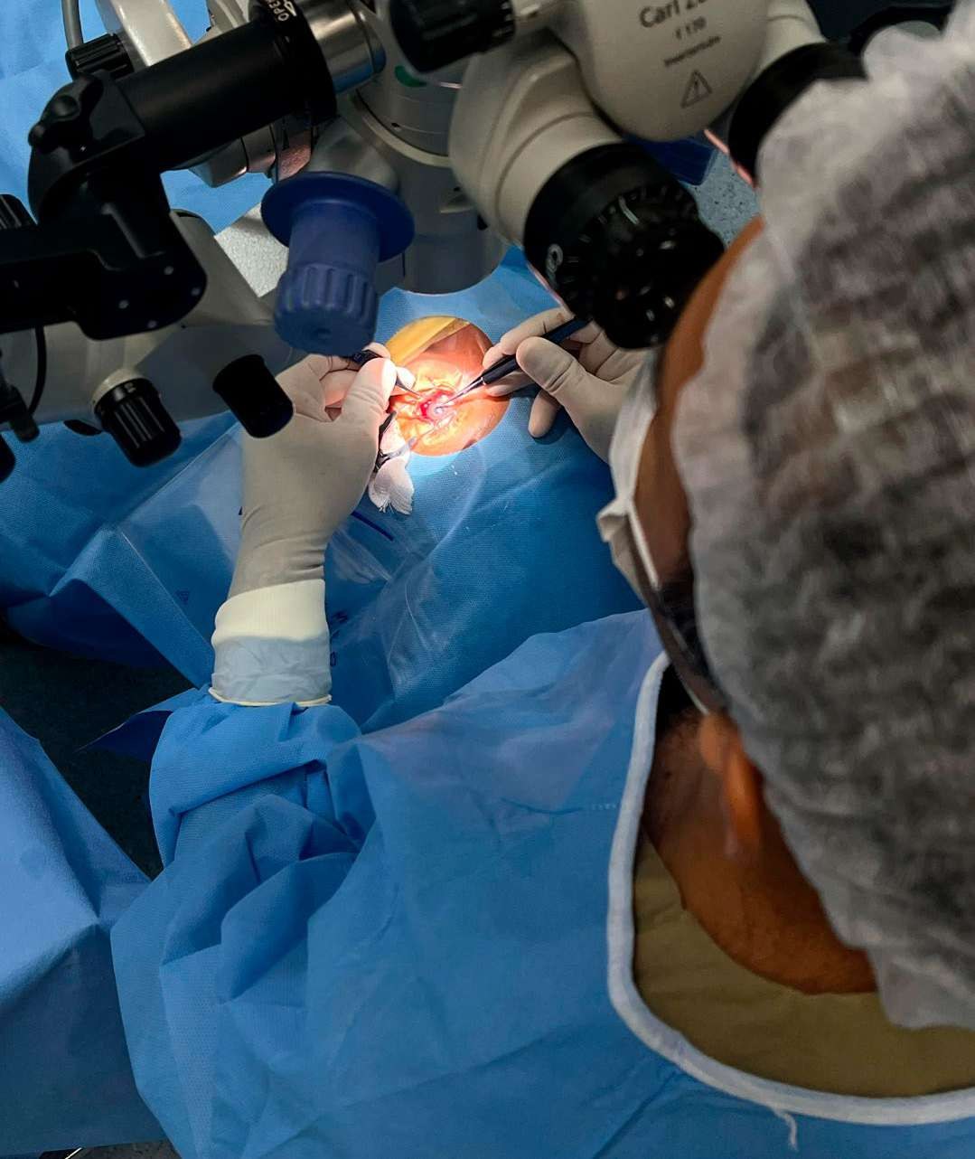 Cirurgião realiza transplante de córnea com microscópio