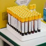 Amostras de sangue