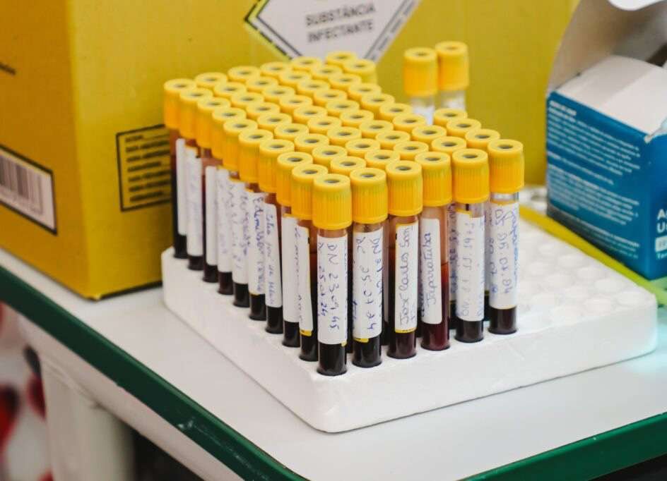Amostras de sangue