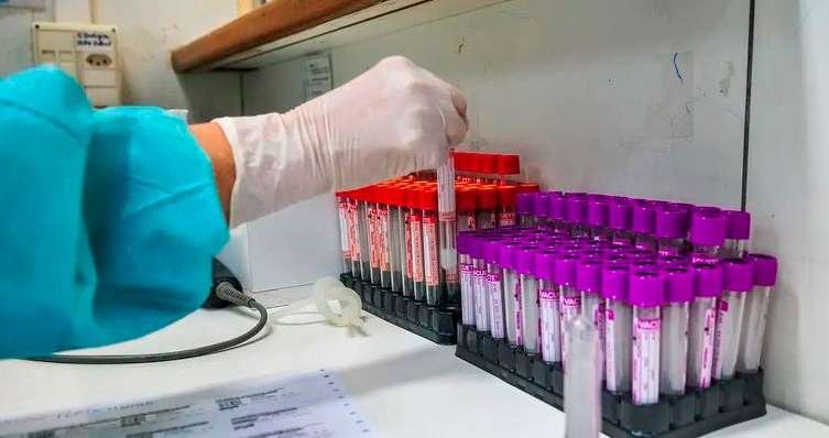 Mão com luva manipula tubos de coleta de sangue